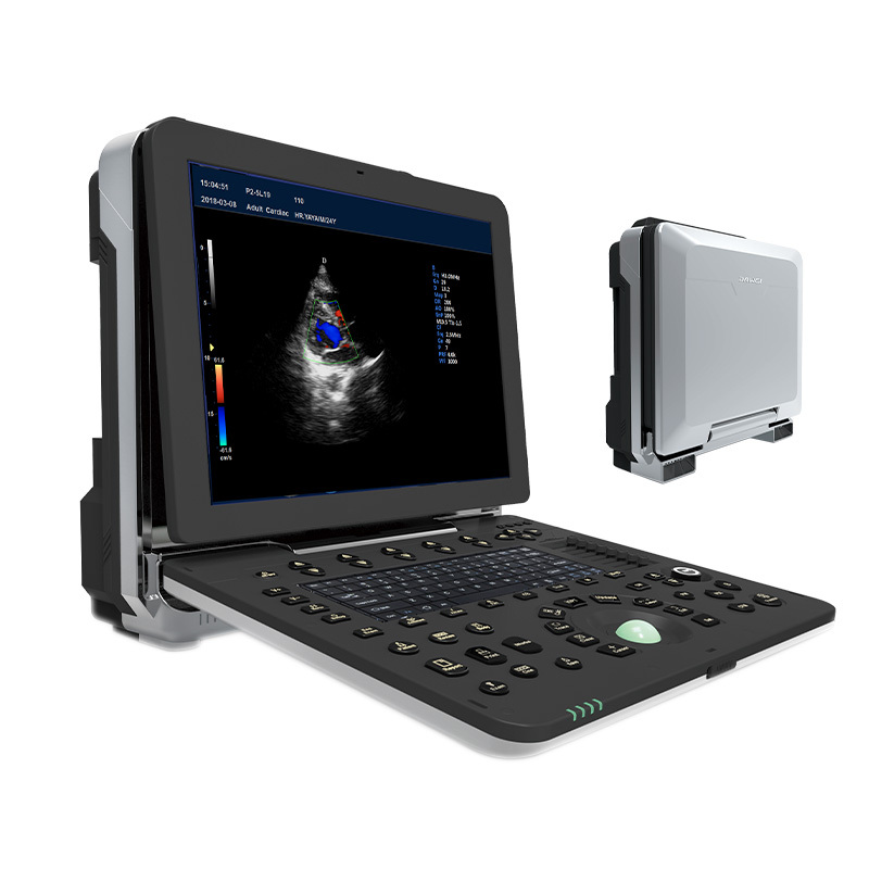 Medical Full Digital Ultrasonic Diagnostic Apparatus Portable Color Ultrasonic Diagnostic Apparatus