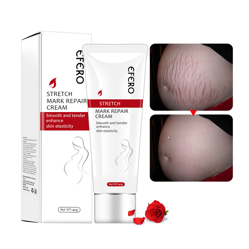 EFERO Best Anti Stretch Marks Removal Cream Organic