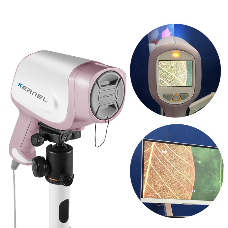 Kernel KN-2200IH CE Cleared Colposcopio Colposcope Full Hd Vagina Colposcope Factory Price Colposcope for gynecology examination