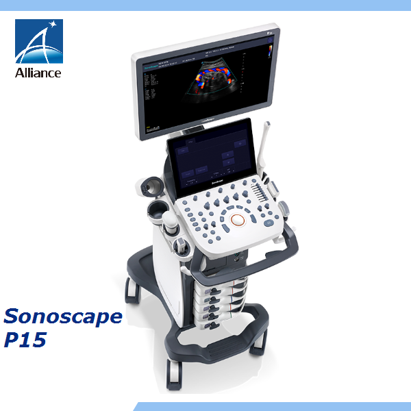 Sonoscape P15 4D корзину цвет Ультразвуковой/повышения вашего ультразвукового экзамен