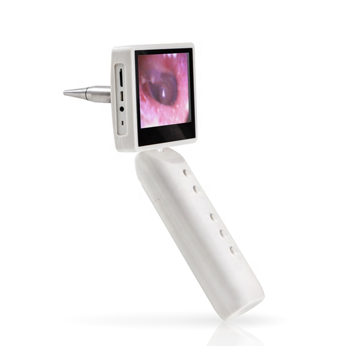 Портативный цифровой медицинский Otoscope носорог и ларингоскоп с зондами камеры