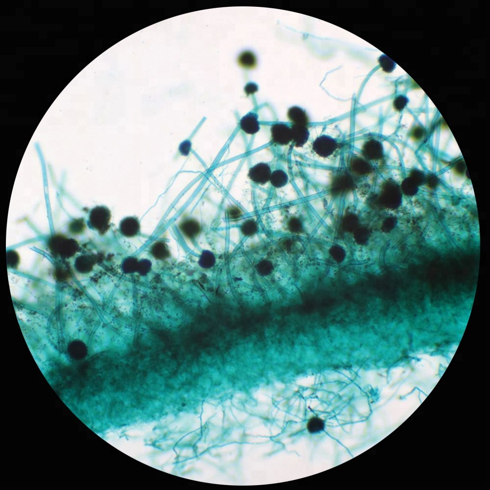 Оптическое стекло грибов наблюдения aspergillus микроскоп шлепанцы без задника с открытыми пальцами