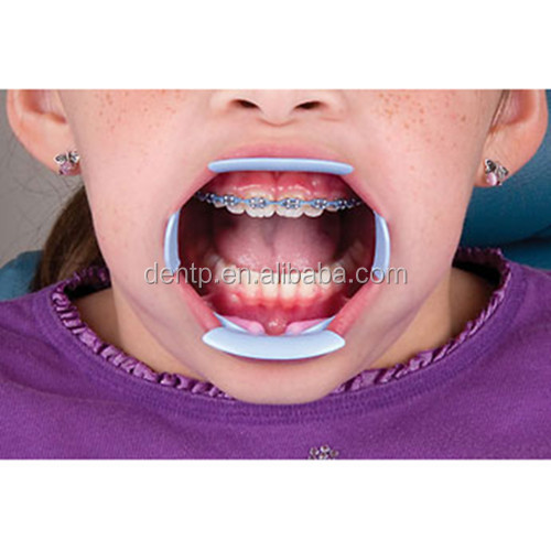 Up To Global Standard Teeth Whiten Intraoral Cheek Retractors / Zoom Cheek Retractors / Tongue Cheek Retractor