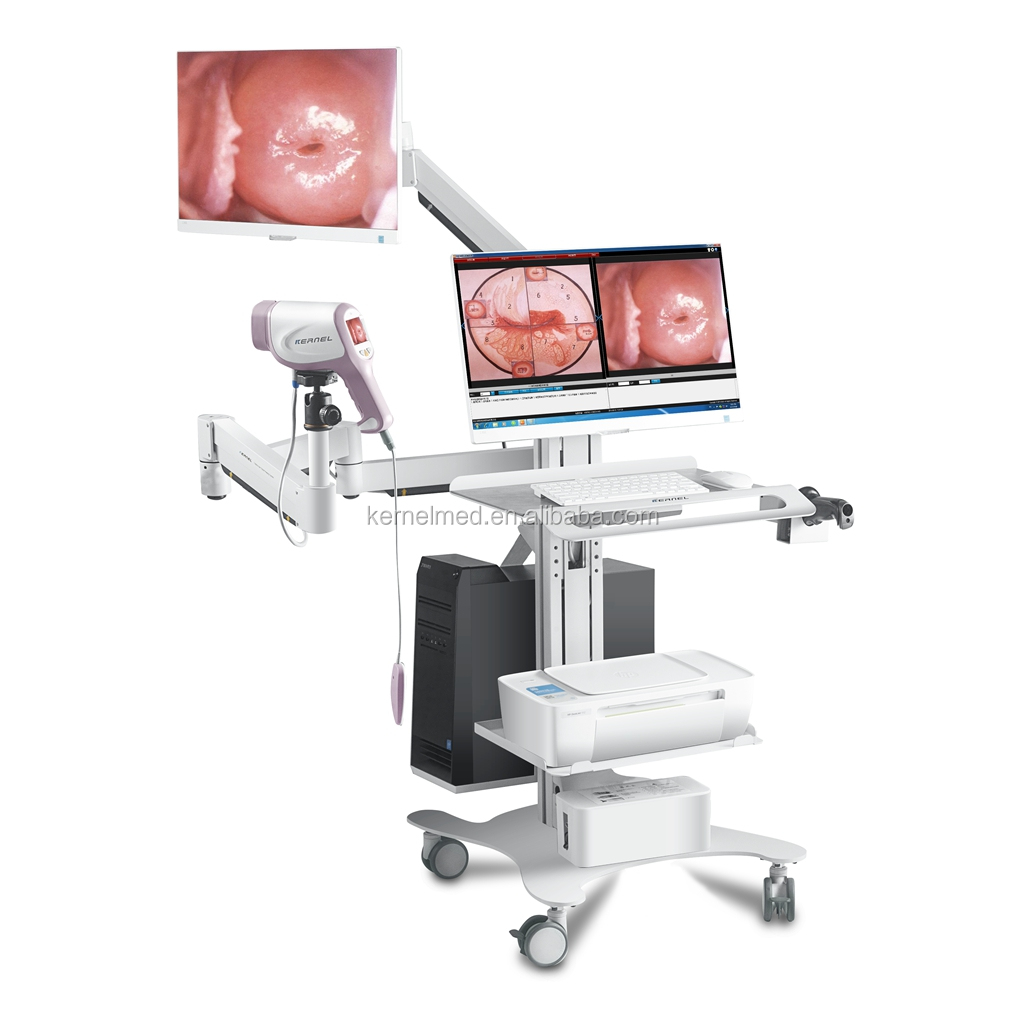 CE утвержден HD colposcope для гинекологии цифровой визуализации системы двойной экран full hd камера влагалища colposcope в больнице