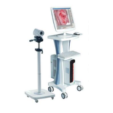 Hot Digital Colposcope Imaging System AJ-100B