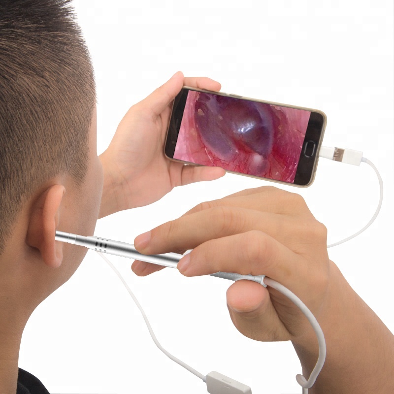 Дешевый и тонкий цифровой otoscope с камерой ушной эндоскоп камера система