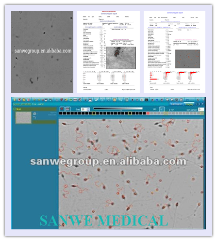 Automatic Sperm Analyzer with good price/Lab machine analysis for semen