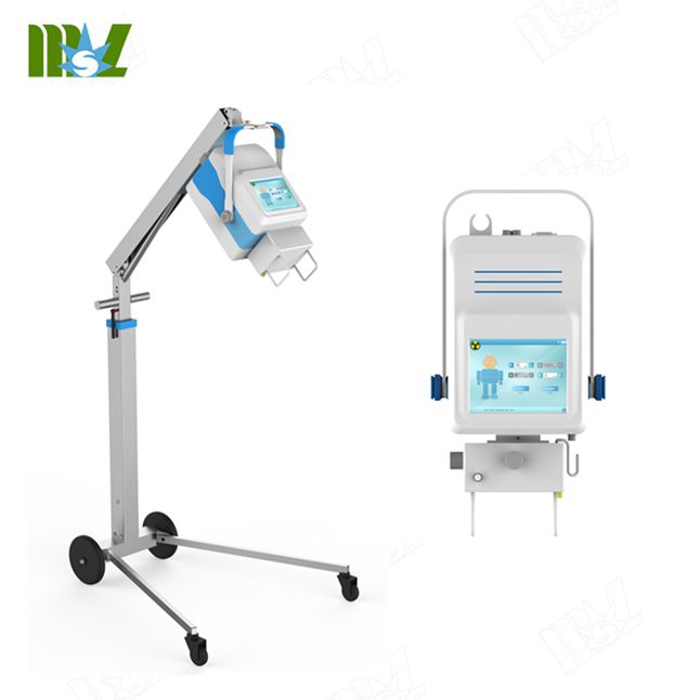 Дешевый 5.6kw 10-100mA высокая частота портативный x-ray машина цифровой диагностический рентгеновские системы с сенсорный ЖК-экран для человека