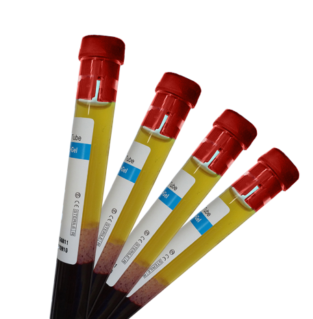 8ml Angel Sodium Citrate With Gel Arthrex Anticoagulant 10ml 15ml PRP Kit Tube Easy Beauty PRP Tube With ACD Gel