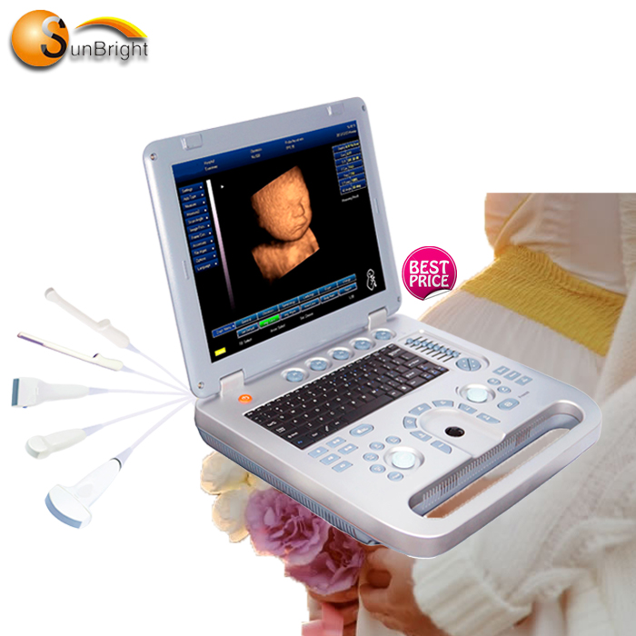 Портативная ультразвуковая 3d-сканирующая машина OB GYN, используется машина с выпуклым зондом и трансвагинальным зондом