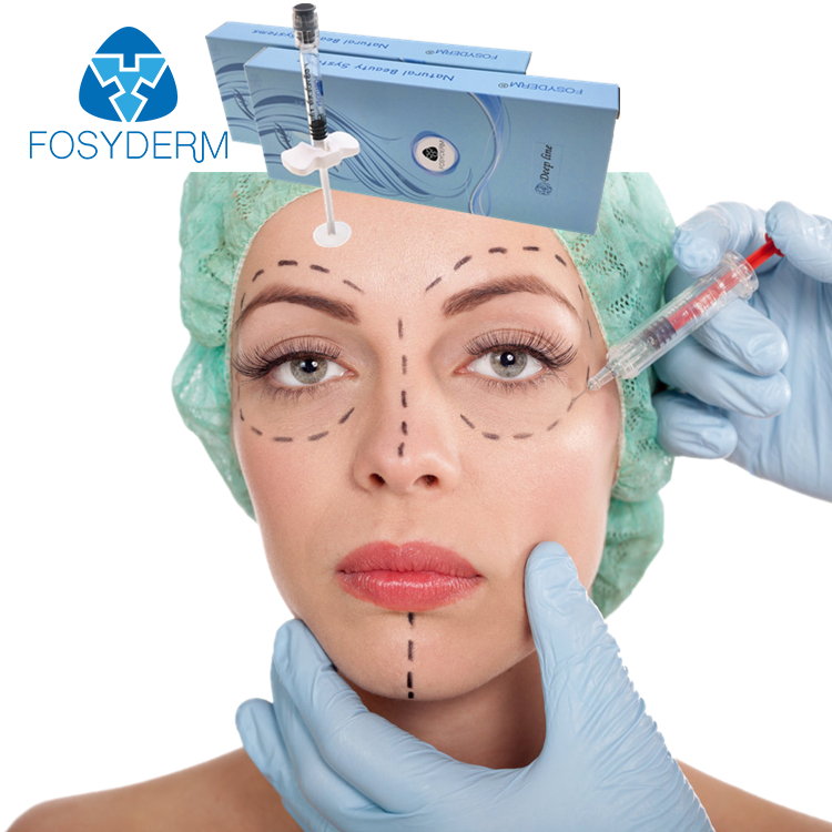 Fosyderm 2 мл купить инъекционные кожные наполнители кальция Гиалуроновая кислота для лица пластик