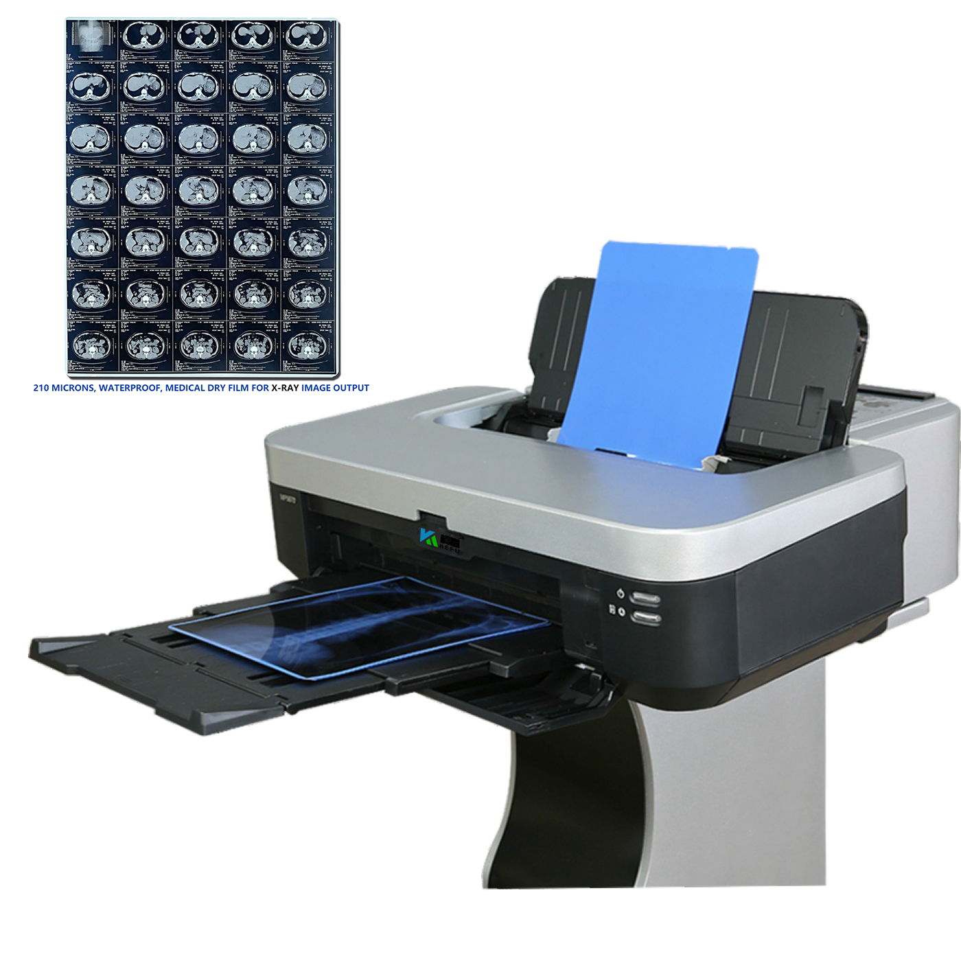 13X17inch медицинская струйная рентгеновская пленка для CT DR MR для принтеров Epson Canon