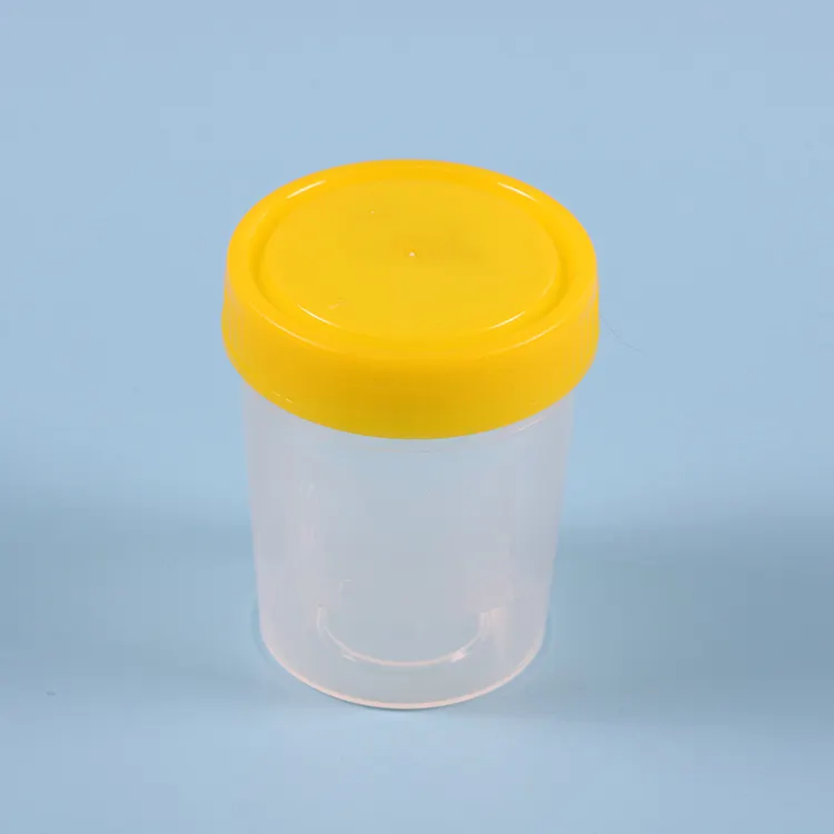 Контейнер для мочи цена. VACUETTE urine Cup - контейнер для мочи (встр.держатель). Контейнер для забора мочи / specimen Container,100ml-120ml, Bulk, 500pcs/CTN. Контейнер для мочи 120 мл стерильный. Баночка для мочи 60мл и 120 мл.