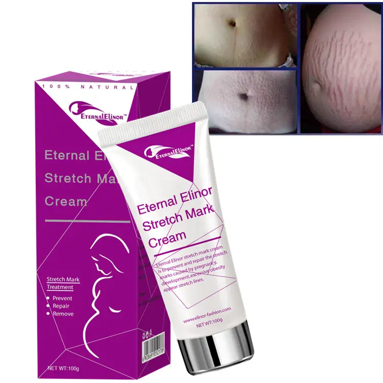 Stretch Marks Remove Scar Treatment Cream Face Whitening Cream Pimple Scar Pregnancy Nourish Postpartum
