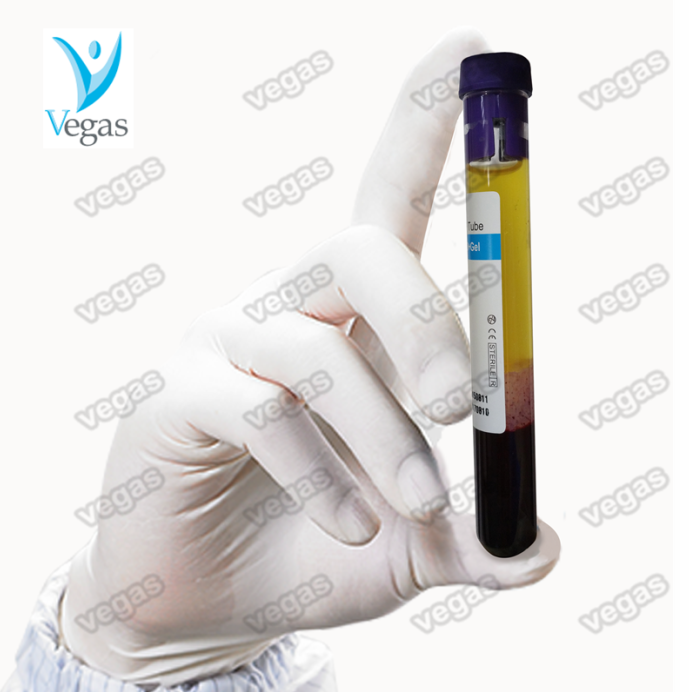 Высокая концентрация тромбоцитов 10 мл и 15 мл prp tube и PRP kit