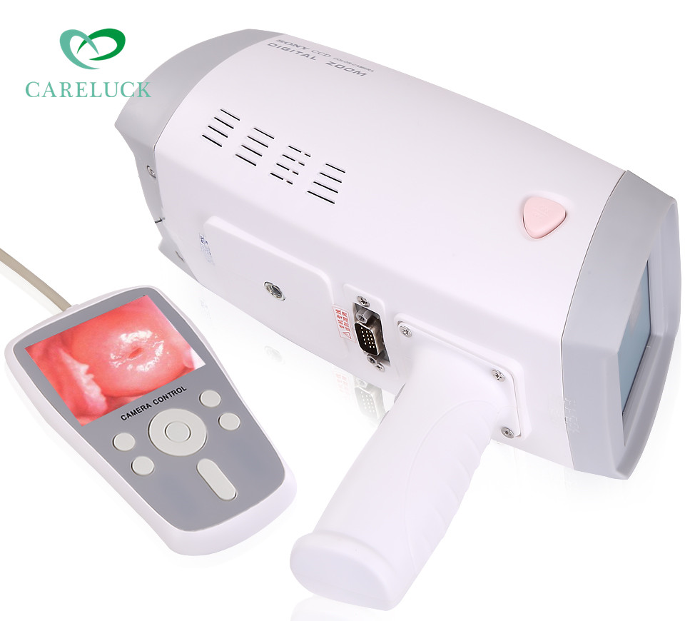 Быстрая доставка, машины colposcope, цифровая камера для медицинского использования
