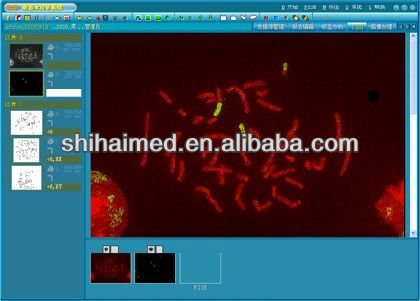SH Chromosome Авто кариотипирование образ системы