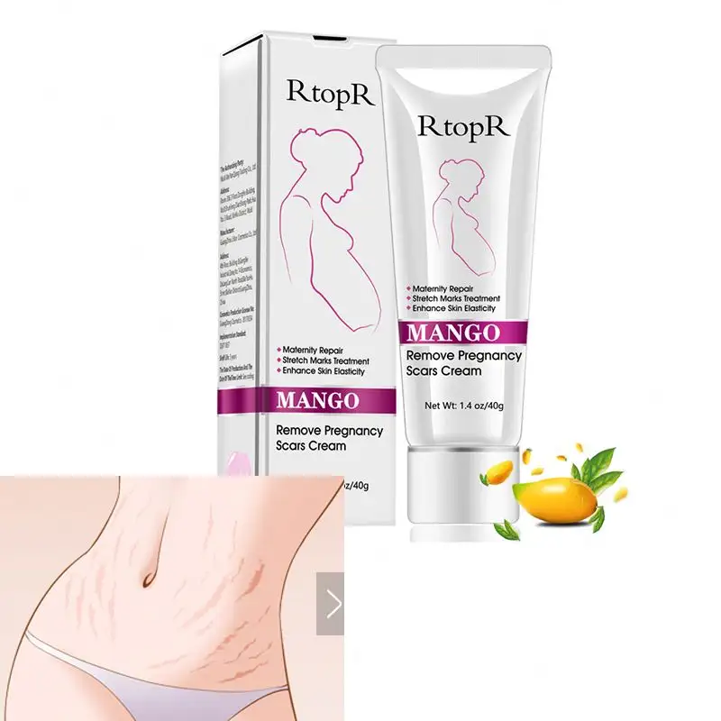 Mango Remove Pregnancy Scars Acne Cream Stretch Marks Treatment Maternity Repair Anti-Aging Anti Firming Body Creams