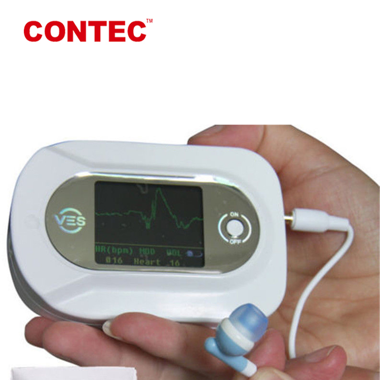 CONTEC CMS-VE визуальное электронное медицинское оборудование Одобрено CE spo2 ecg стетоскоп estetoscopio