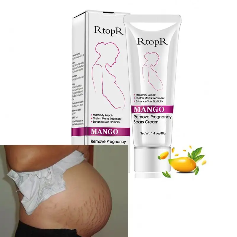 LOW MOQ After Pregnancy Natural Repairing Whitening Skin Remove Repair Anti Stretch Marks Cream