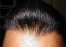 toupee