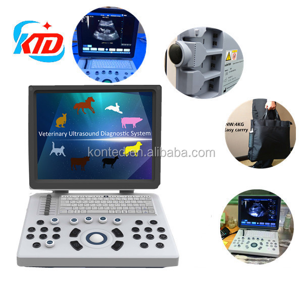 Portable Ultrasound Scanner USG Sonography Echo Ultrasonography Machines / Medical Ultrasound imaging