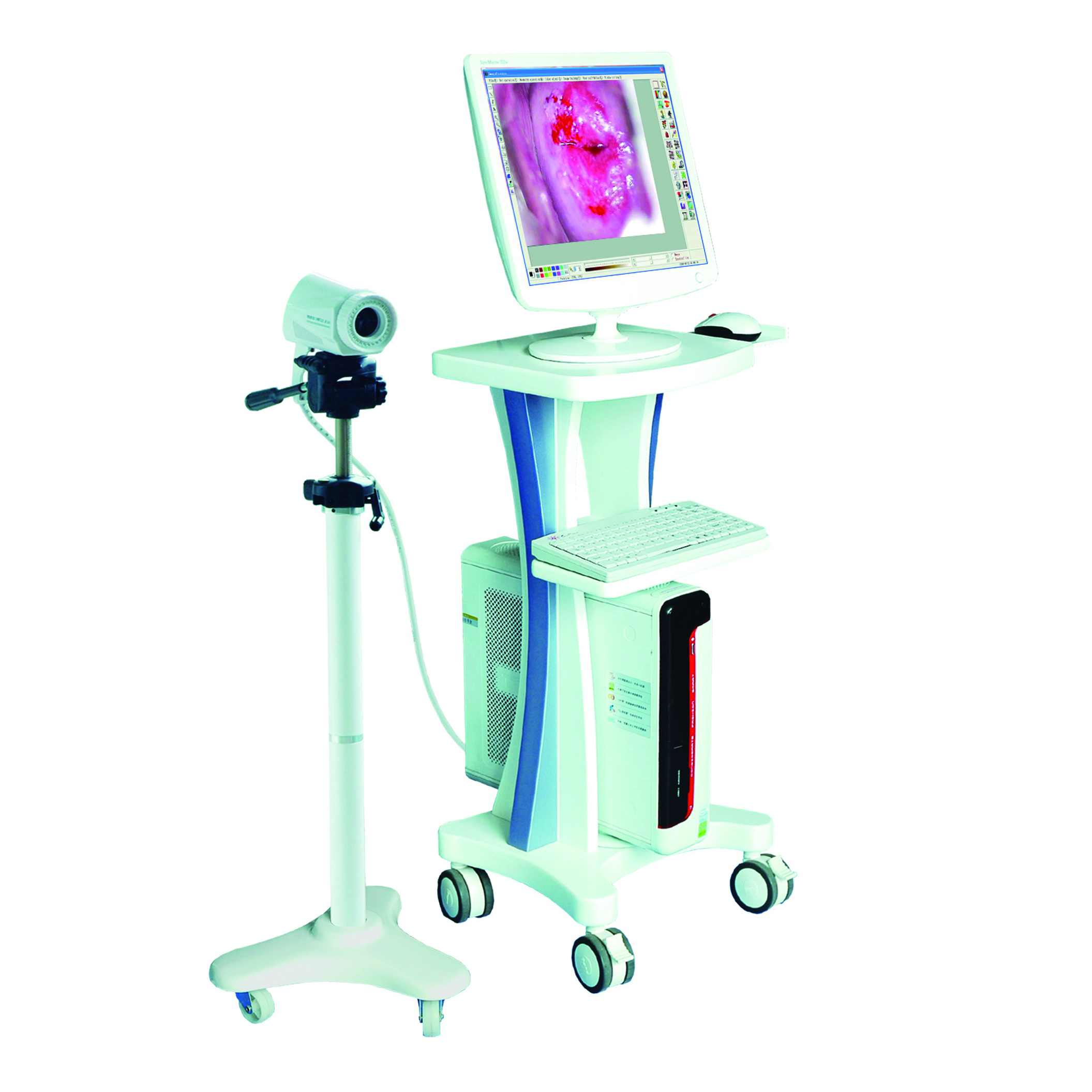 Портативный HD Full Digital Electronic Colposcope для вагинального обследования цена LA-2100I