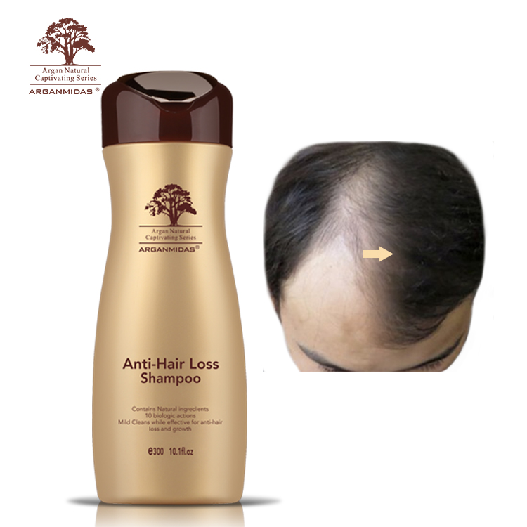 Herbal Anti Dandruff Anti Alopecia Hair Grow Shampoo Anti Hair Loss Treatment for Men