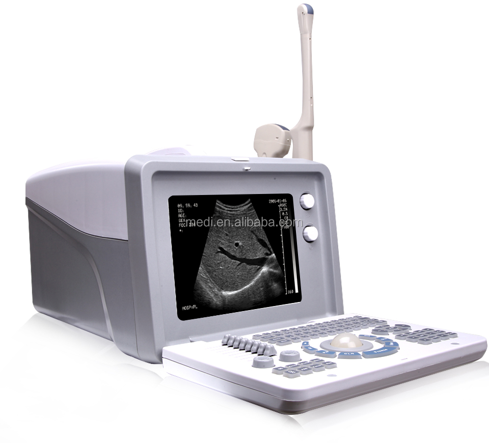 Medical Equipment pregnancy scanner ultrasound