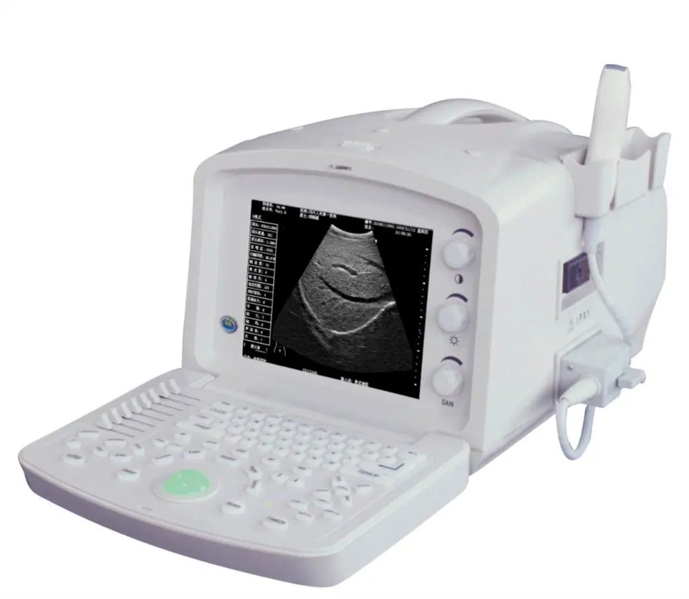 Ultrasound Machine Price Good Price Hospital Portable Human Use Ultrasound Machine