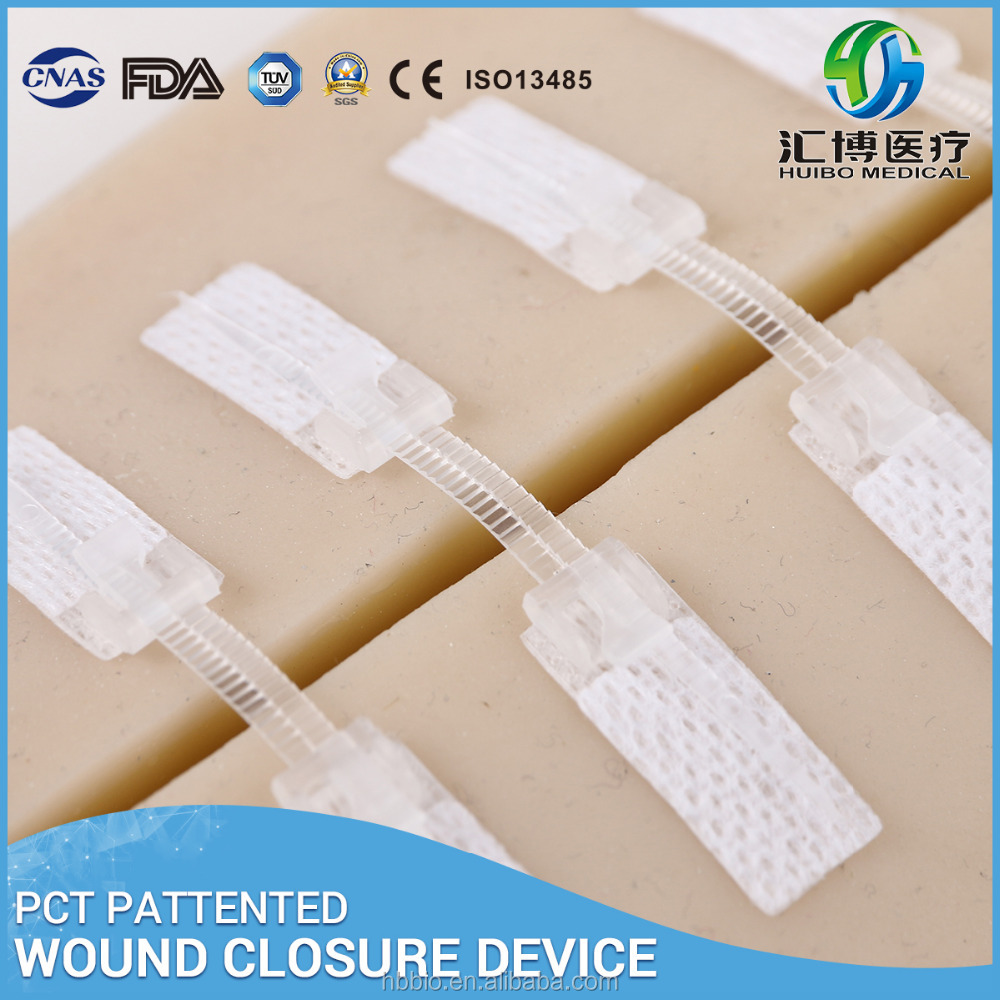 CE/FDA/ISO одобренный дешевый стерилизованный степлер для закрытия ран