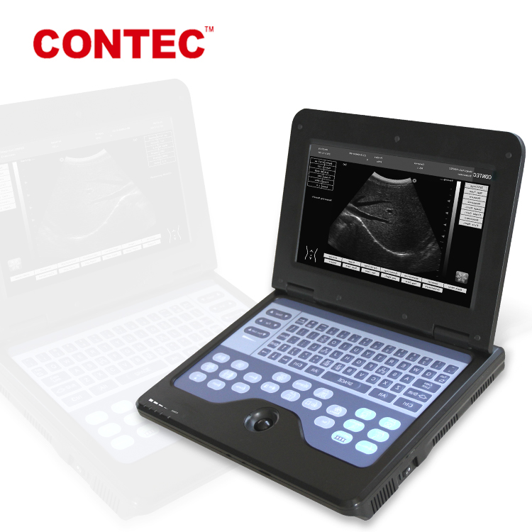 Ультразвуковая машина CONTEC CMS600P2 b от qinhuangdao contec medical