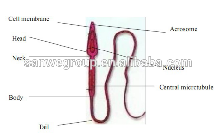 Automatic Sperm Analyzer with good price/Lab machine analysis for semen
