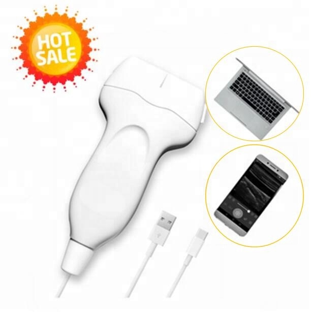Ручка ультразвуковой зонд 80 элементов USB беспроводной линейный зонд IOS/Android системы