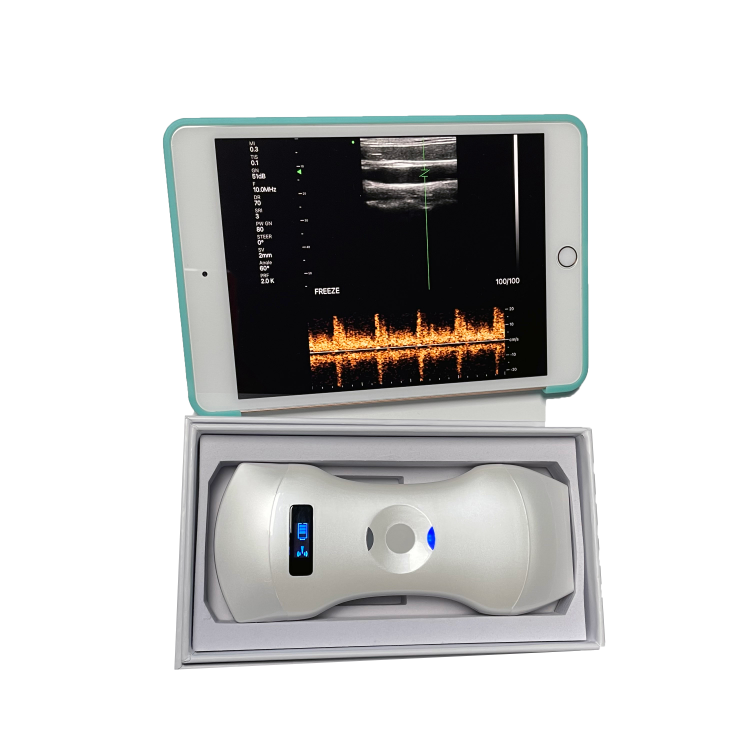 Affordable Wireless 3 in 1 Color Ultrasound Wi-Fi Connect Double Probe Ultrasound