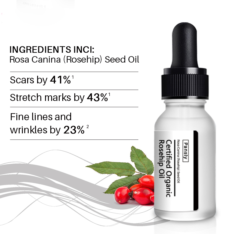Best stretch marks cream Whitening Skin Scar Repair Best Stretch Marks Removal Cream