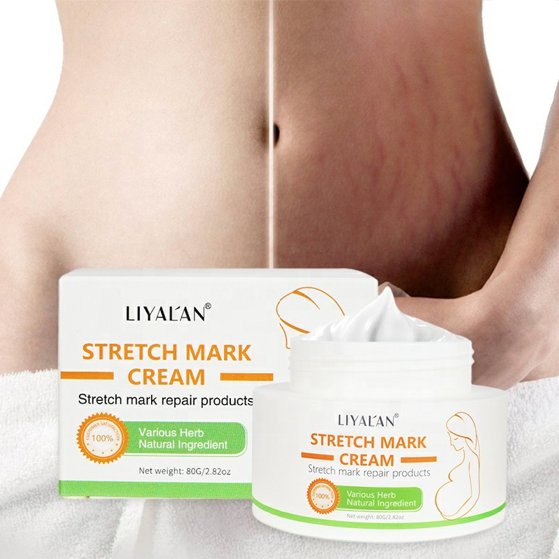Private Label Stretchmark Remover Cream Natural Organic Body Scar Repair Slack Line Pregnancy Abdomen Anti Stretch Mark Cream