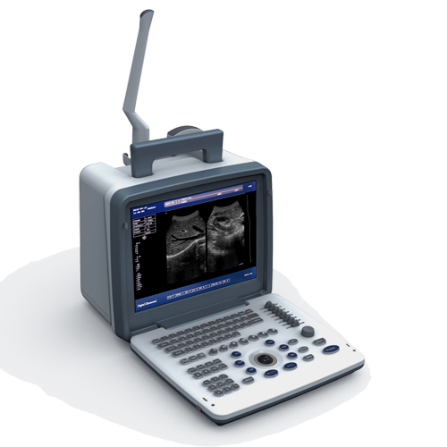 Mecan Medical Ultrasound Instruments Portable Equipos De Ultrasonido Ecografo Ultrasound Machine for Human and Pets