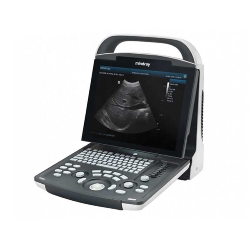 Портативный ультразвук Mindray DP-20