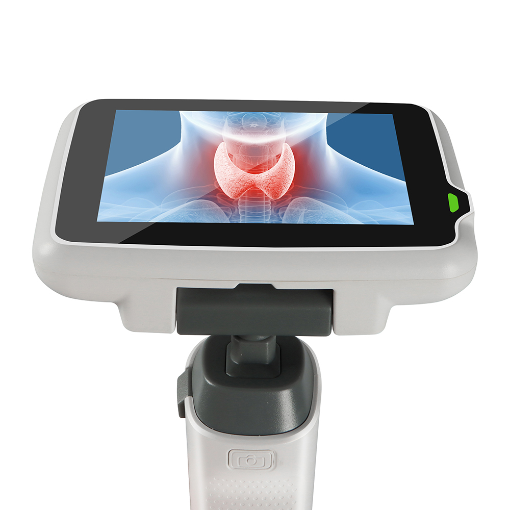 Videoscope Video Laryngoscope Price With Four Reusable Blades For Surgical