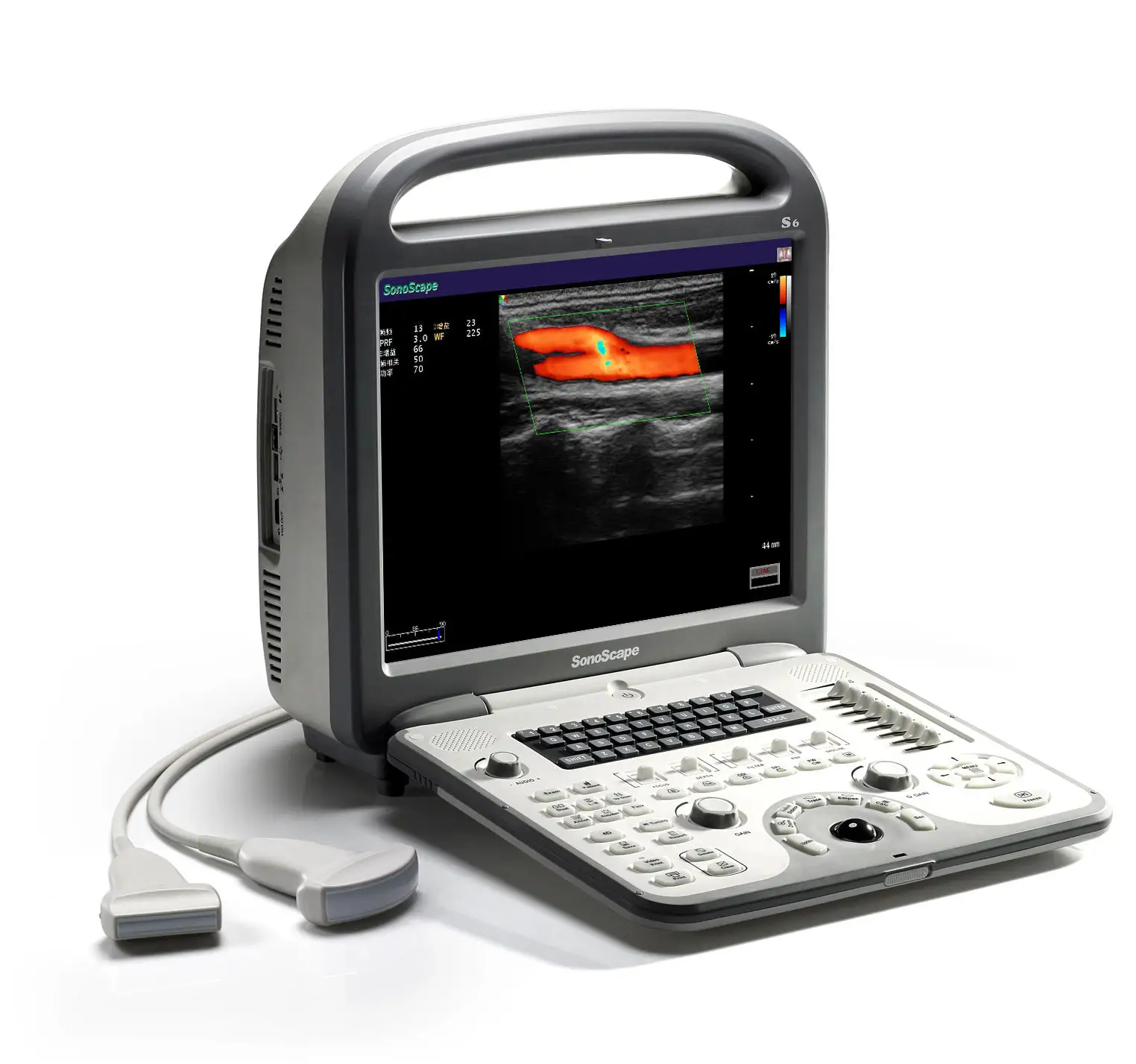 Hot Sell Sonoscape s6 Medical Hospital Doppler Ultrasound Equipment