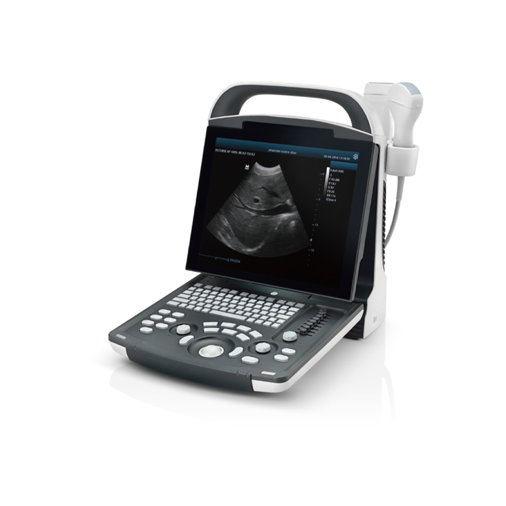 Mindray For the examination and diagnosis The DP-10 full digital portable ultrasound diagnostic system is used