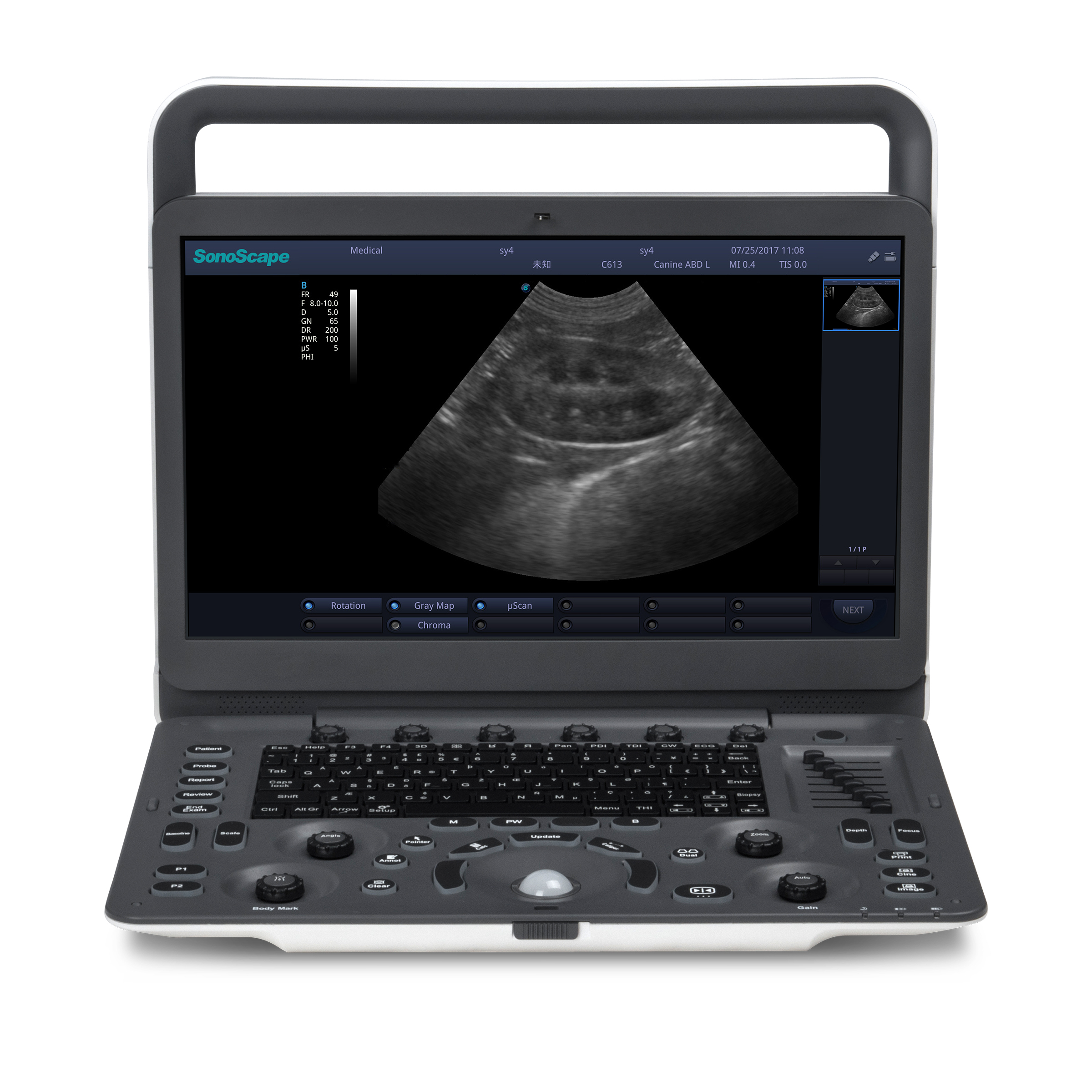 Sonoscope E1V Portable Ultrasound Diagnostic System Capable B/W Ultrasound For Veterinary Care Ultrasound Scanner