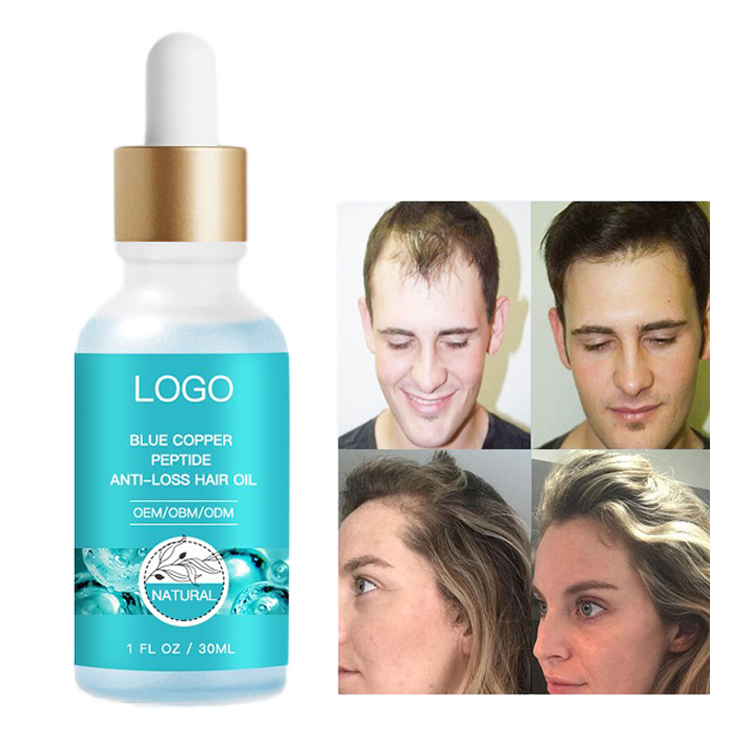 New Formula Hair Loss Treatment Product Fast Hair Growth Biotin Peptide Serum Oil for Men and Women