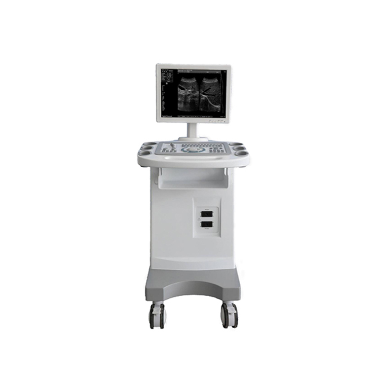 UBW1100 Cheap Price Clinical 2D Digital Scan Black and White Trolley Ultrasound Machine