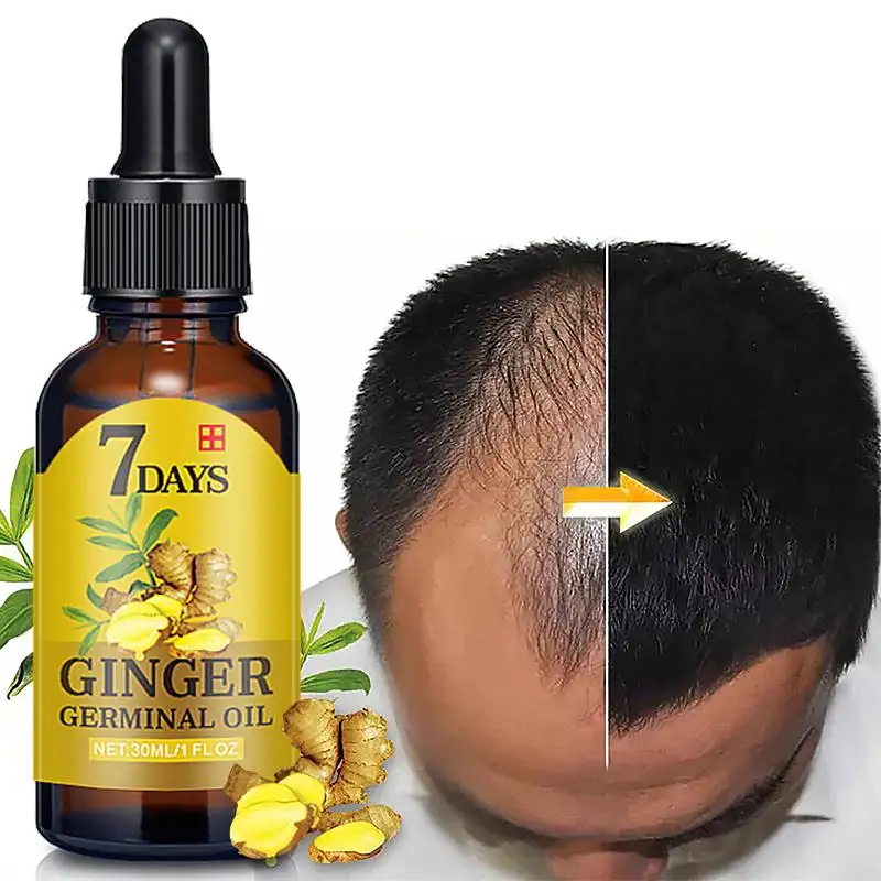 Wholesale 30ml Ginger Oil 7 Days Hair Growth Essential Oil For Hair Loss Treatment Regrowth Serum