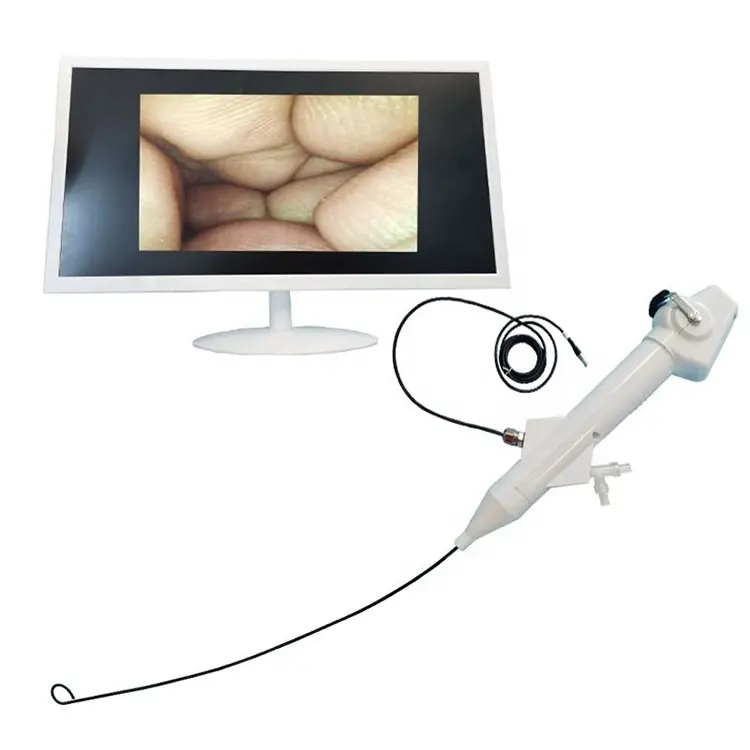 Flexible ureteroscope lithotripsy surgical instrument can observe digital bladder and kidney stones surgical instrument