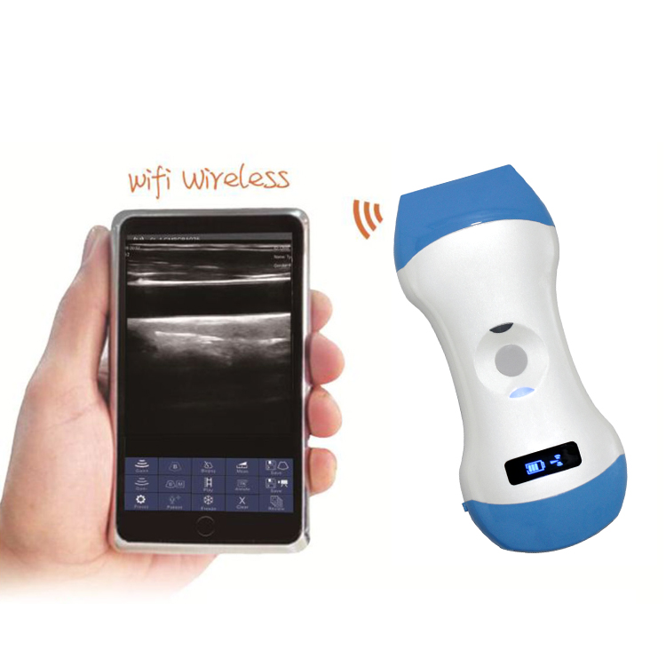MEDSINGLONG 96 elements ultrasound scanner Mini ultrasound probe for iOS Android Windows
