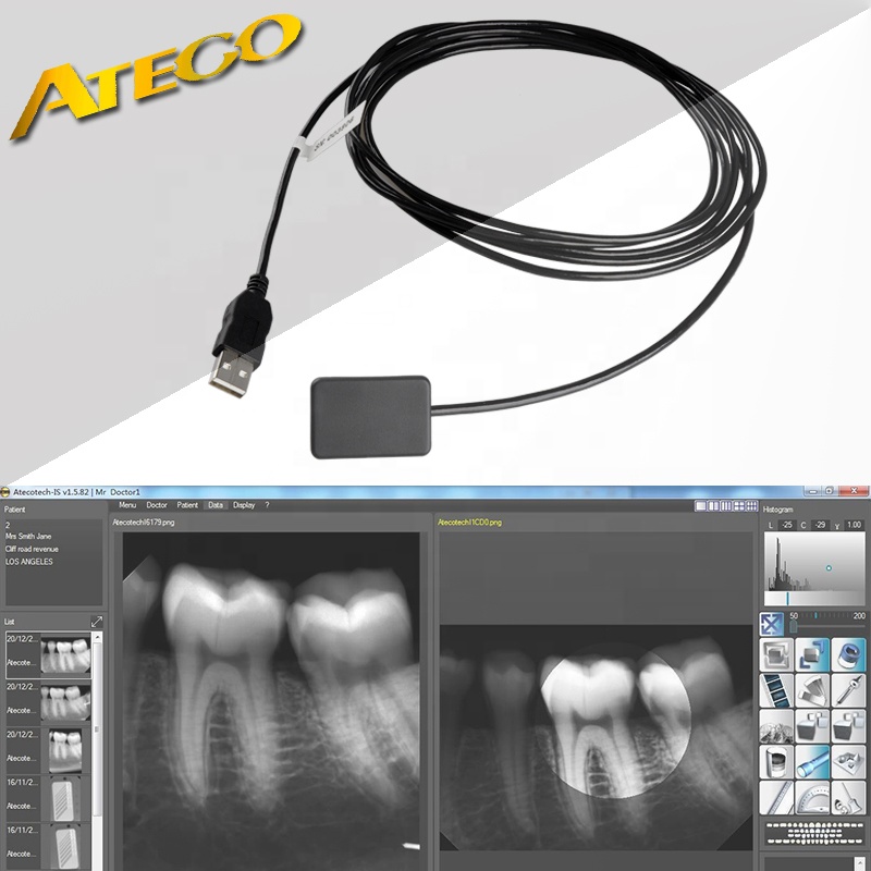 Аутентичный цифровой стоматологический рентгеновский Датчик UK Ateco, цена