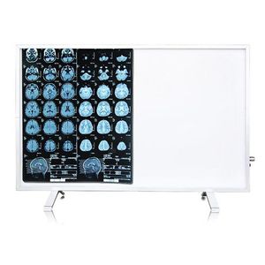 14*17 Inch Medical Plastic Films Manual or Electric Power Source for Dry Laser Printers